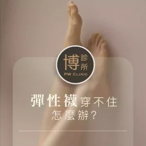 靜脈曲張常見的症狀_彈性襪穿讀著怎麼辦