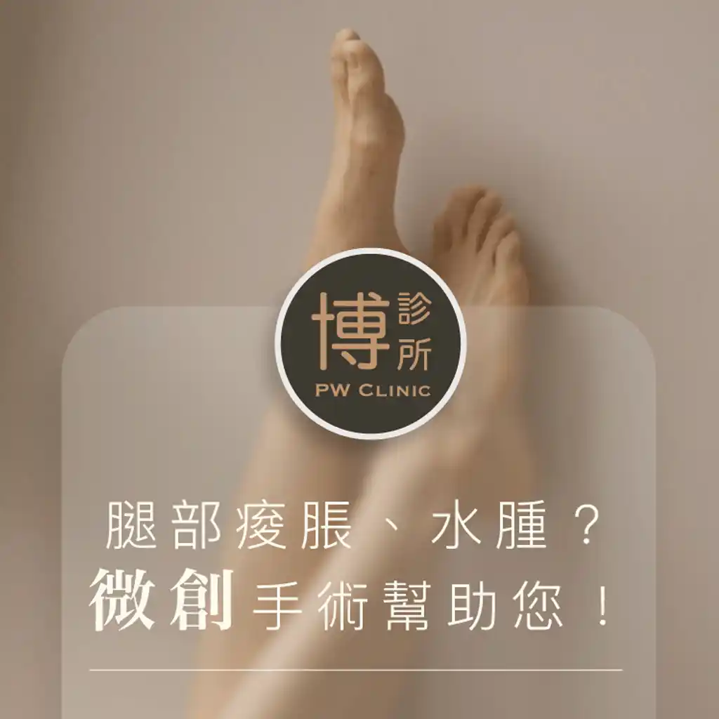 腿部痠脹水腫微創手術幫助您