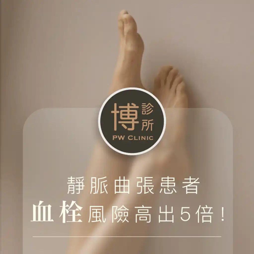 靜脈曲張患者血栓風險高出5倍