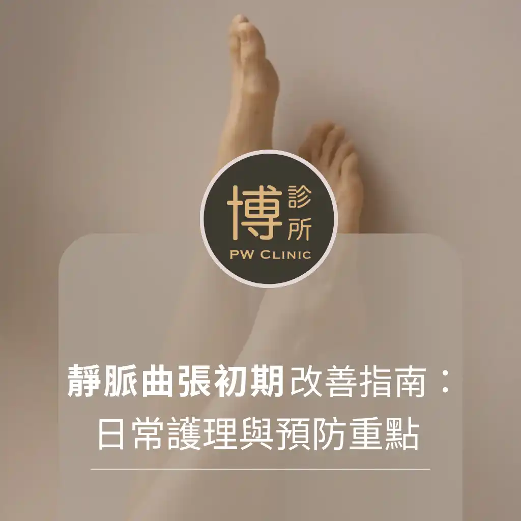 博診所-靜脈曲張初期改善指南：醫師教你日常護理與預防重點
