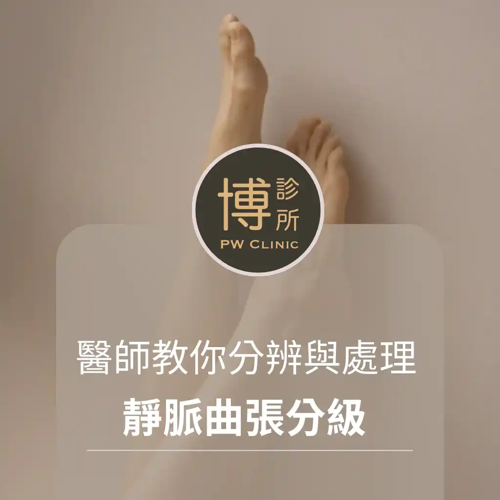 博診所-靜脈曲張分級說明｜從蜘蛛網到潰瘍，醫師教你分辨與處理