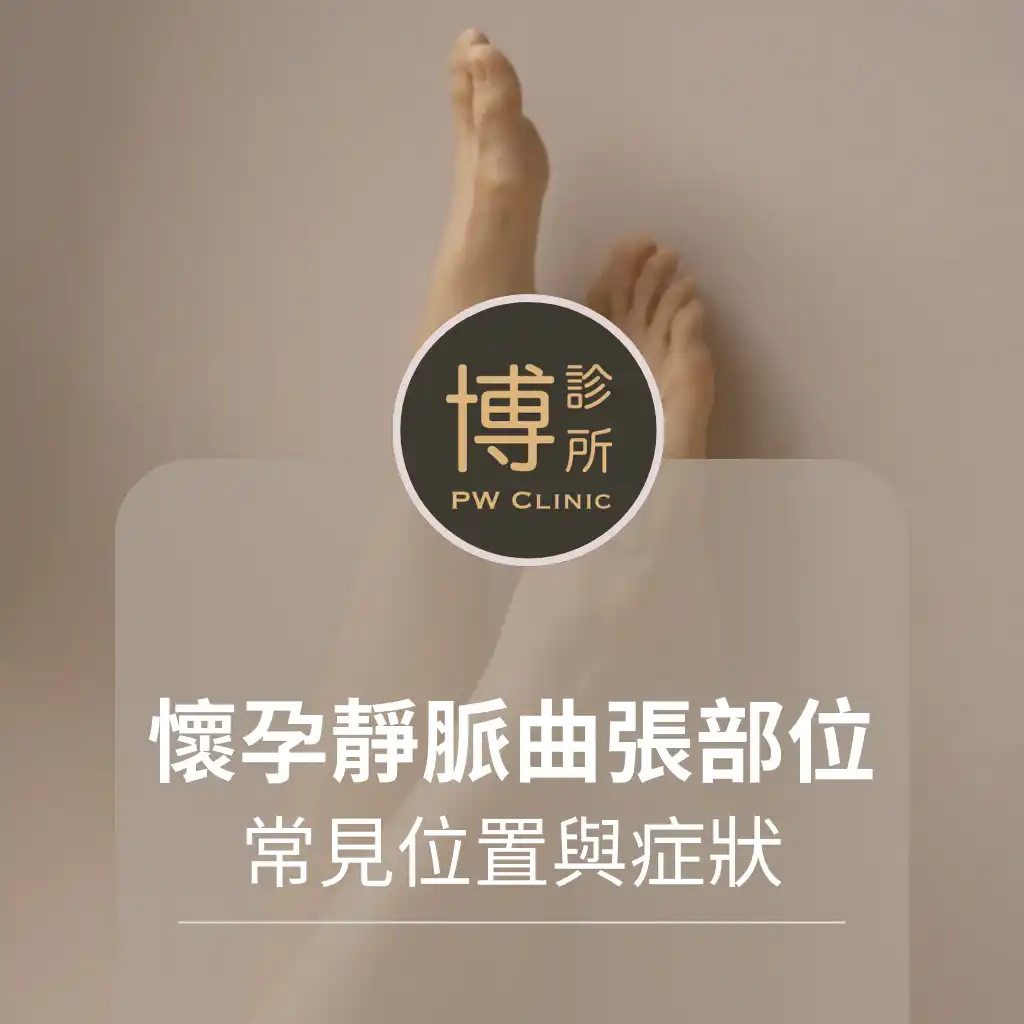 博診所-懷孕靜脈曲張部位有哪些？常見位置與症狀一次看懂