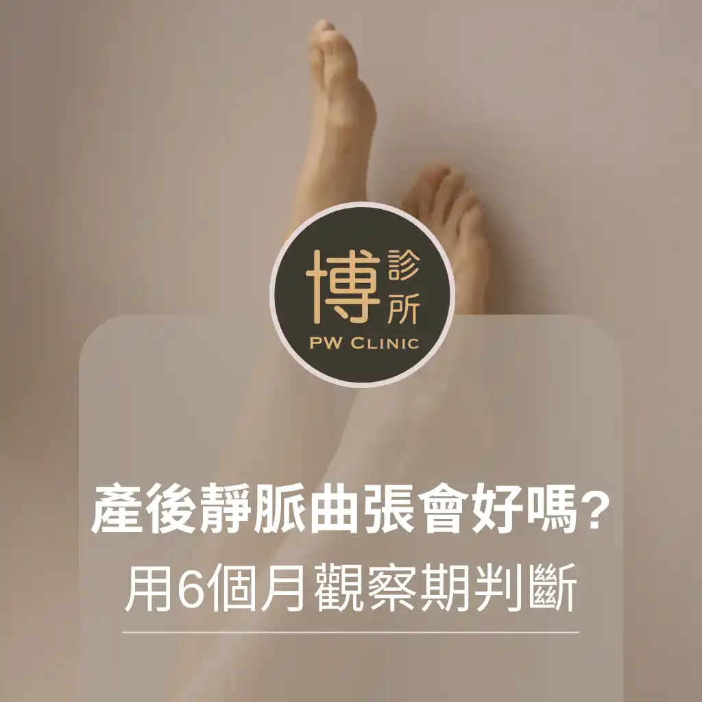 博診所-產後靜脈曲張會好嗎？用 6 個月觀察期判斷是否需治療