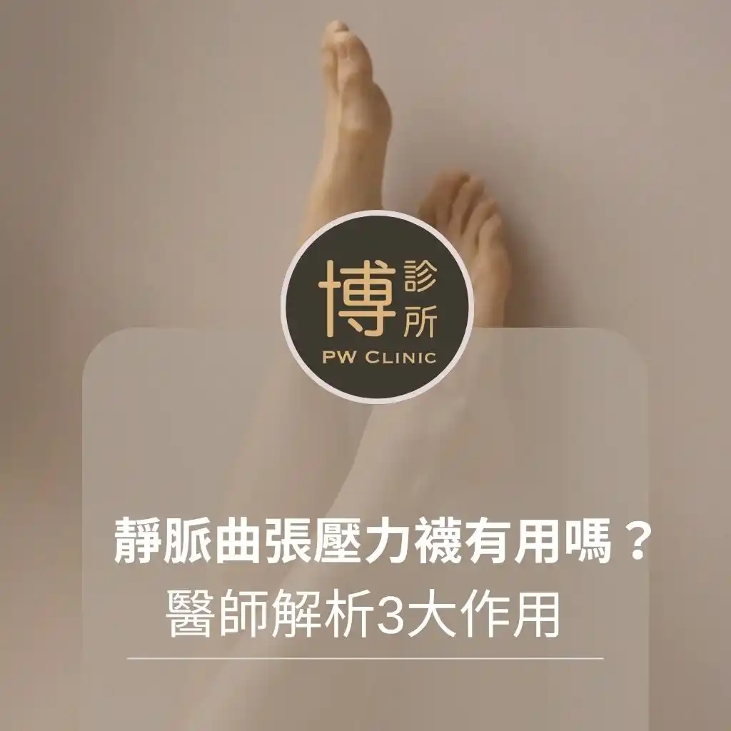 博診所-靜脈曲張穿壓力襪有用嗎？醫師解析3大作用