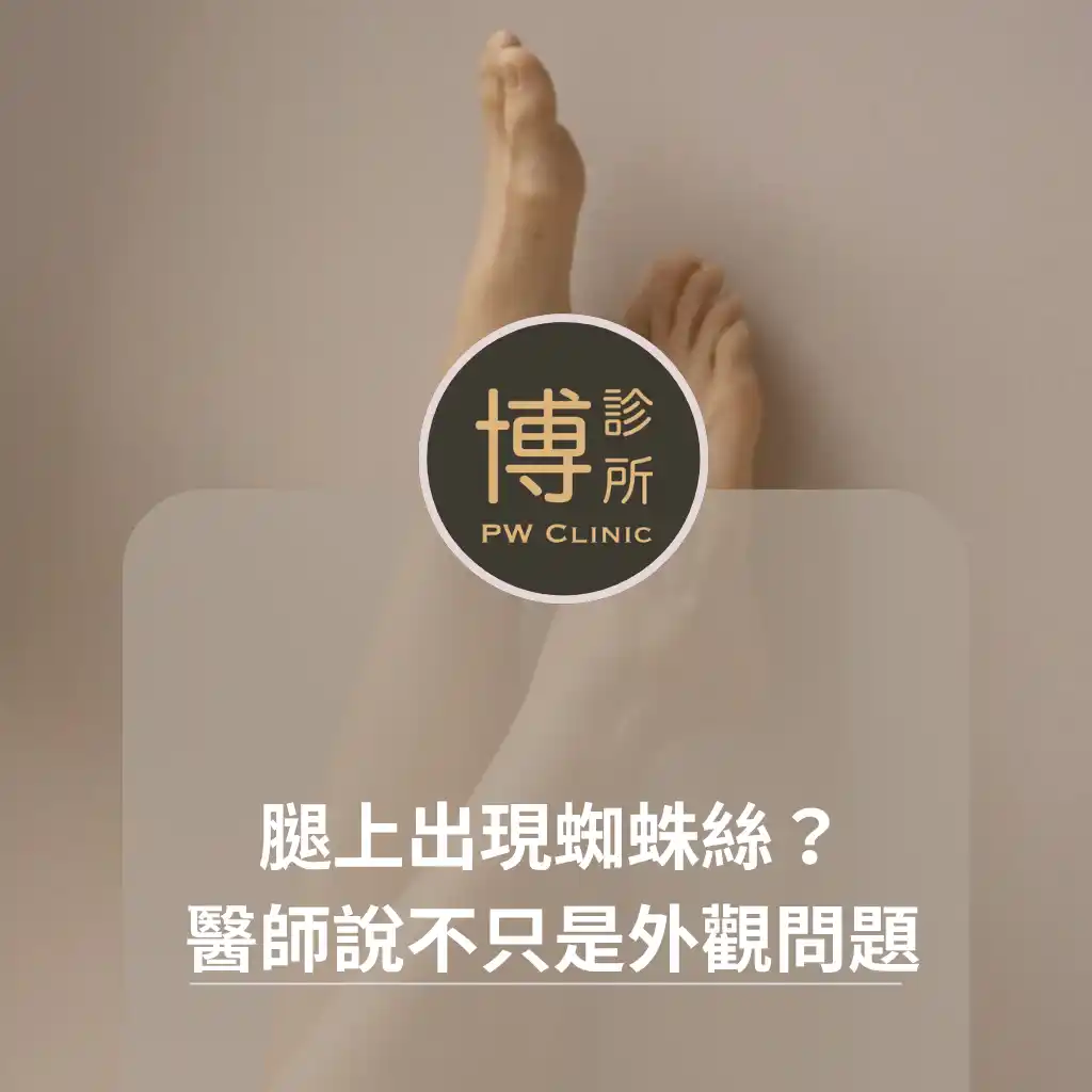 博診所-腿上出現蜘蛛絲？醫師說不只是外觀問題