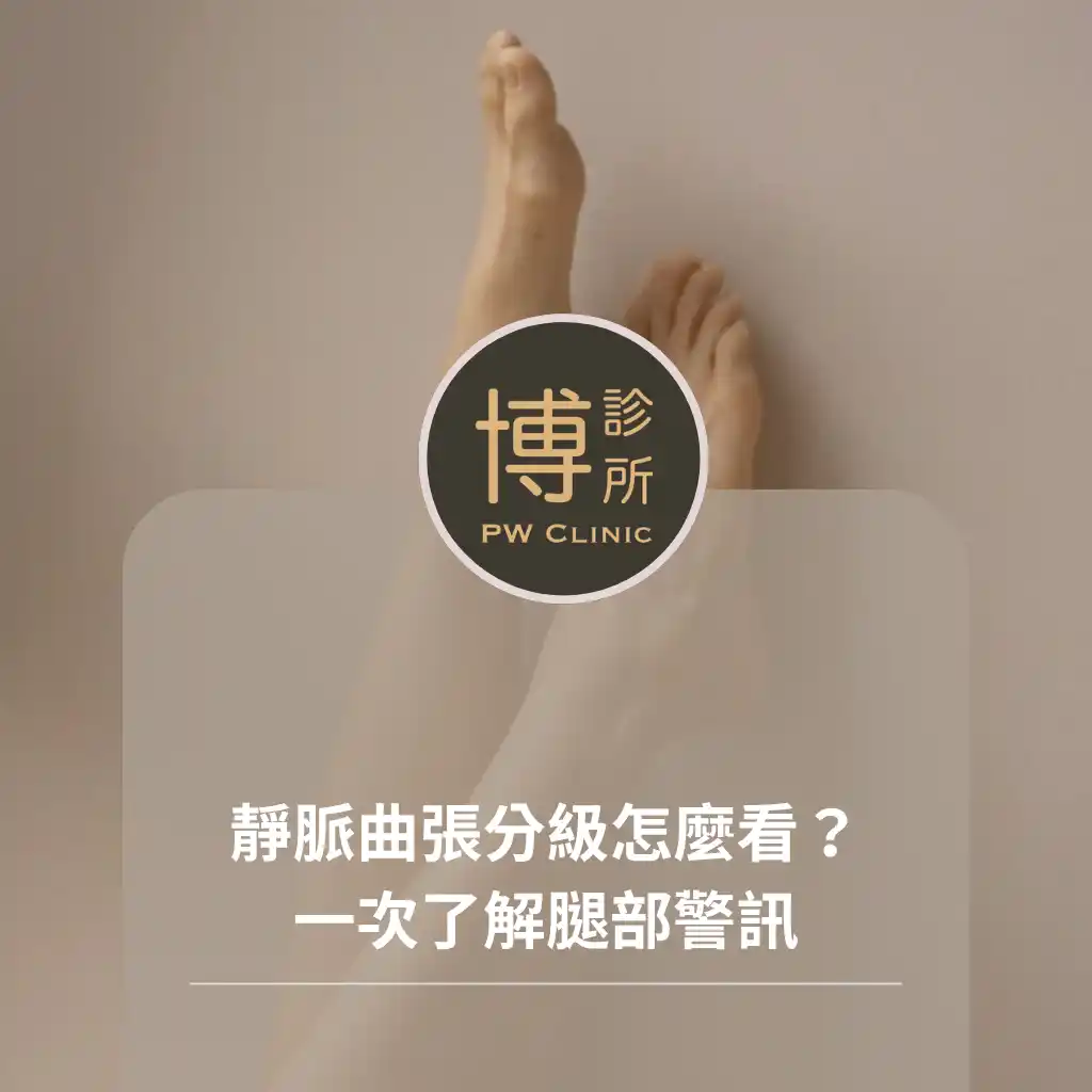 博診所-靜脈曲張分級怎麼看？一次了解腿部警訊，別等腿開始抗議才檢查