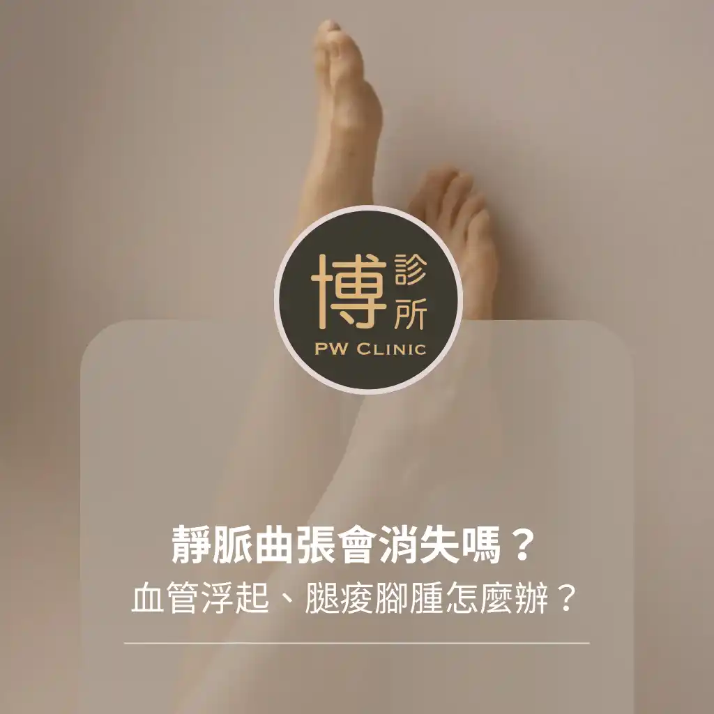 博診所-靜脈曲張會消失嗎？血管浮起、腿痠腳腫該怎麼辦？